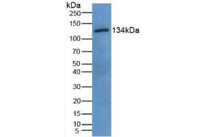 Detection of EGF in Porcine Uterus Tissue using Polyclonal Antibody to Epidermal Growth Factor (EGF) (EGF 抗体  (AA 45-275))