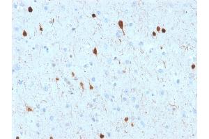 Formalin-fixed, paraffin-embedded human Cerebellum stained with Calretinin Mouse Monoclonal Antibody (CALB2/2602). (Calretinin 抗体  (AA 23-242))