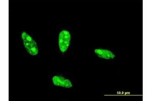 Immunofluorescence of monoclonal antibody to NHLH2 on HeLa cell. (NHLH2 抗体  (AA 36-135))
