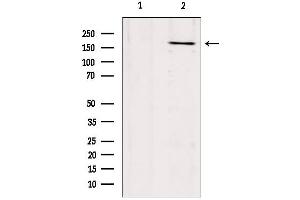 Western Blotting (WB) image for anti-Collagen, Type XVII, alpha 1 (COL17A1) (N-Term) antibody (ABIN6260957)