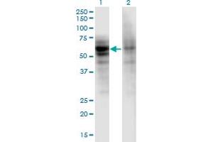 Western Blot analysis of DSTYK expression in transfected 293T cell line by DSTYK monoclonal antibody (M06), clone 1F9. (DSTYK 抗体  (AA 80-189))