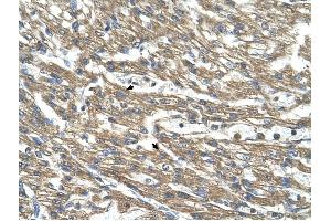 Cystathionase antibody was used for immunohistochemistry at a concentration of 4-8 ug/ml to stain Myocardial cells (arrows) in Human Head. (CTH 抗体)
