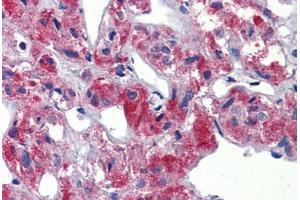 Human Adrenal (formalin-fixed, paraffin-embedded) stained with TAL1 antibody ABIN462261 followed by biotinylated goat anti-rabbit IgG secondary antibody ABIN481713, alkaline phosphatase-streptavidin and chromogen. (TAL1 抗体  (C-Term))