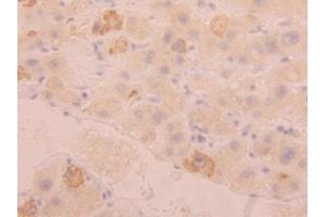 Detection of FGL1 in Human Liver Tissue using Polyclonal Antibody to Fibrinogen Like Protein 1 (FGL1) (FGL1 抗体  (AA 23-312))