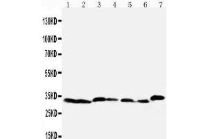 Western Blotting (WB) image for anti-Caspase 6, Apoptosis-Related Cysteine Peptidase (CASP6) (AA 24-44), (N-Term) antibody (ABIN3043219)