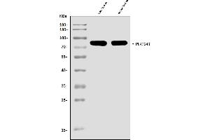 Western blot analysis of cPLA2 beta/PLA2G4B using anti-cPLA2 beta/PLA2G4B antibody (ABIN7602174).