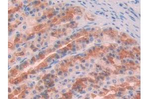 DAB staining on IHC-P; Samples: Rat Stomach Tissue (GAS6 抗体  (AA 356-511))