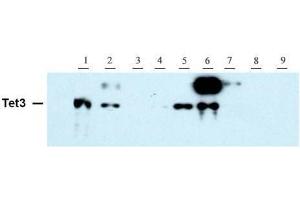 Tet3 antibody (pAb) tested by Western blot. (TET3 抗体  (AA 1159-1329))