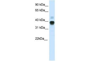 HOXA11 antibody used at 0. (Homeobox A11 抗体  (C-Term))