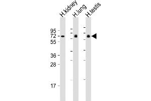 All lanes : Anti-LRRC1 Antibody (Center) at 1:2000 dilution Lane 1: human kidney lysate Lane 2: human lung lysate Lane 3: human testis lysate Lysates/proteins at 20 μg per lane. (LRRC1 抗体  (AA 298-330))
