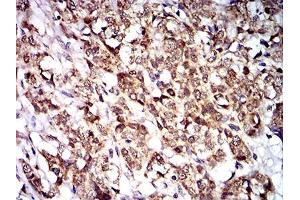 Immunohistochemistry (IHC) image for anti-Protein tyrosine Phosphatase, Non-Receptor Type 14 (PTPN14) (AA 896-1169) antibody (ABIN5542696)