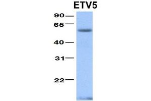 Host:  Rabbit  Target Name:  ETV5  Sample Type:  Human Fetal Heart  Antibody Dilution:  1. (ETV5 抗体  (N-Term))