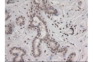 Immunohistochemical staining of paraffin-embedded breast using anti-STAT3 (ABIN2452542) mouse monoclonal antibody. (STAT3 抗体  (AA 154-175))