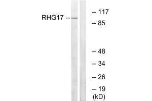 Western blot analysis of extracts from LOVO cells, using RHG17 antibody. (ARHGAP17 抗体)