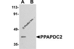 Western Blotting (WB) image for anti-Phosphatidic Acid Phosphatase Type 2 Domain Containing 2 (PPAPDC2) (C-Term) antibody (ABIN1030597) (PPAPDC2 抗体  (C-Term))