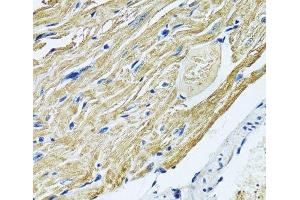 Immunohistochemistry of paraffin-embedded Mouse heart using SLC5A6 Polyclonal Antibody at dilution of 1:100 (40x lens). (SLC5A6 抗体)