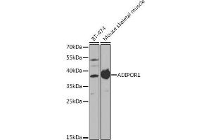 Western blot analysis of extracts of various cell lines, using  antibody (ABIN3022036, ABIN3022037, ABIN3022038 and ABIN6218580) at 1:1000 dilution. (Adiponectin Receptor 1 抗体  (AA 1-136))