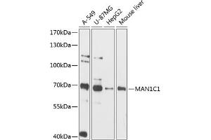 Western blot analysis of extracts of various cell lines, using MC1 antibody (ABIN6131495, ABIN6143452, ABIN6143453 and ABIN6216608) at 1:3000 dilution. (MAN1C1 抗体  (AA 44-240))