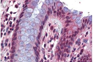 Human Colon: Formalin-Fixed, Paraffin-Embedded (FFPE) (SRSF4 抗体  (AA 359-408))