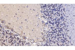 Detection of SHH in Human Cerebellum Tissue using Monoclonal Antibody to Hedgehog Homolog, Sonic (SHH) (Sonic Hedgehog 抗体  (AA 36-193))