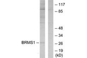 Western blot analysis of extracts from 293 cells, using BRMS1 Antibody. (BRMS1 抗体  (AA 21-70))
