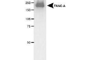 Western blot analysis of FANCA in transfected COS-1 cell lysate using FANCA polyclonal antibody . (FANCA 抗体)