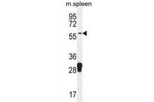 Western Blotting (WB) image for anti-Molybdenum Cofactor Synthesis 1 (MOCS1) antibody (ABIN2995584) (MOCS1 抗体)