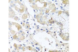 Immunohistochemistry of paraffin-embedded Human stomach using RPL36 Polyclonal Antibody at dilution of 1:100 (40x lens). (RPL36 抗体)