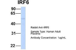 Host:  Rabbit  Target Name:  IRF6  Sample Type:  Human Adult Placenta  Antibody Dilution:  1. (IRF6 抗体  (Middle Region))