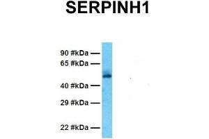 Western Blotting (WB) image for anti-Serpin Family H Member 1 (SERPINH1) (C-Term) antibody (ABIN2792207)