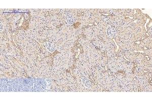 Immunohistochemistry of paraffin-embedded Rat kidney tissue using CD21 Monoclonal Antibody at dilution of 1:200. (CD21 抗体)