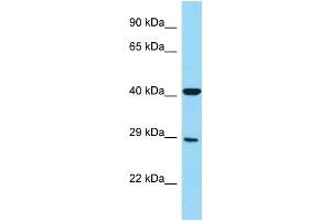 WB Suggested Anti-FCGR3A Antibody Titration: 1. (FCGR3A 抗体  (Middle Region))