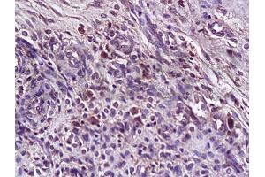 Formalin-fixed and paraffin embedded rat uterus tissue labeled with Anti-TRAILR1 Polyclonal Antibody (ABIN670581), Unconjugated at 1:200, followed by conjugation to the secondary antibody and DAB staining (DR4 抗体  (AA 401-468))
