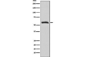 Western blot analysis of Muscarinic Acetylcholine Receptor M3 expression in human fetal brain lysate.