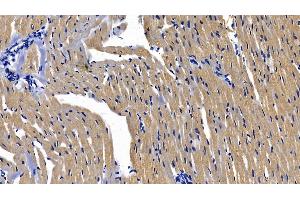 Detection of MyD88 in Rat Cardiac Muscle Tissue using Polyclonal Antibody to Myeloid Differentiation Factor 88 (MyD88) (MYD88 抗体  (AA 1-296))