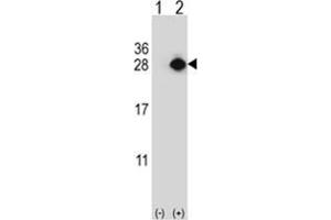 Western blot analysis of YEATS4 (arrow) using rabbit polyclonal YEATS4 Antibody . (GAS41 抗体)