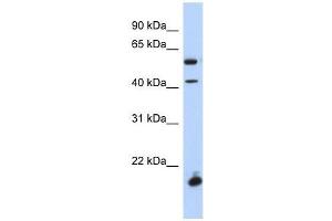 DBX1 antibody used at 0. (DBX1 抗体  (Middle Region))