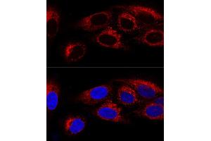 Confocal immunofluorescence analysis of U2OS cells using CK Polyclonal Antibody (ABIN6134474, ABIN6138645, ABIN6138646 and ABIN6223731) at dilution of 1:100. (CKAP4 抗体)