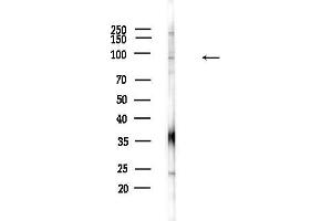 Western blot analysis of lysates from F10-LUC cells(heat-shock,45 min treatment), using IFI16 Antibody at 1/1000 dilution.