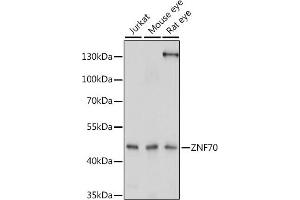 Western blot analysis of extracts of various cell lines, using ZNF70 antibody (ABIN7271522) at 1:1000 dilution. (ZNF70 抗体  (AA 1-140))