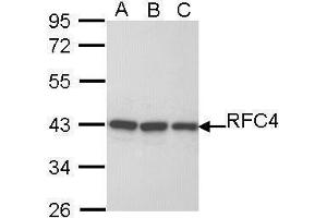 WB Image Sample (30 ug of whole cell lysate) A: H1299 B: Hela C: Hep G2 , 10% SDS PAGE antibody diluted at 1:1000