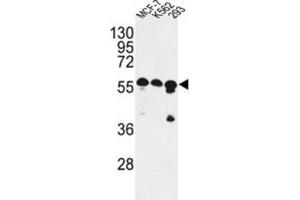 Western Blotting (WB) image for anti-CCR4-NOT Transcription Complex Subunit 4 (CNOT4) antibody (ABIN2998123) (CNOT4 抗体)