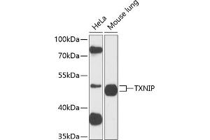 Western blot analysis of extracts of Rat uterus, using TXNIP antibody (ABIN6130776, ABIN6149733, ABIN6149734 and ABIN6224986) at 1:890 dilution.