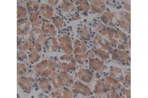 Used in DAB staining on fromalin fixed paraffin- embedded Kidney tissue (CBR1 抗体  (AA 2-277))