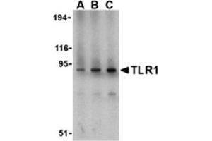 Image no. 1 for anti-Toll-Like Receptor 1 (TLR1) (N-Term) antibody (ABIN318756) (TLR1 抗体  (N-Term))