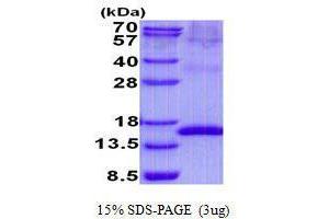 Figure annotation denotes ug of protein loaded and % gel used. (Uroplakin 2 Protein (UPK2))