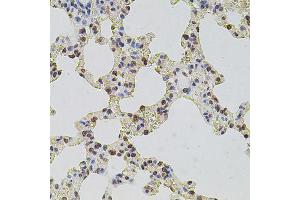 Immunohistochemistry of paraffin-embedded rat lung using HIST1H2AG antibody (ABIN6003627) at dilution of 1/100 (40x lens). (HIST1H2AG 抗体)