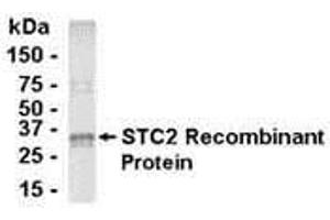 Western Blotting (WB) image for anti-Stanniocalcin 2 (STC2) (AA 20-302) antibody (ABIN2468046) (Stanniocalcin 2 抗体  (AA 20-302))
