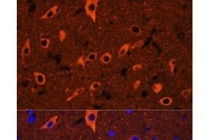Immunofluorescence analysis of Rat brain using TUBB3 Polyclonal Antibody at dilution of 1:100. (TUBB3 抗体)