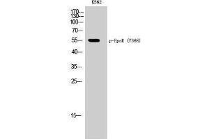 Western Blotting (WB) image for anti-Erythropoietin Receptor (EPOR) (pTyr368) antibody (ABIN3182440) (EPOR 抗体  (pTyr368))